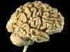 Brain