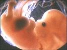 Embryo